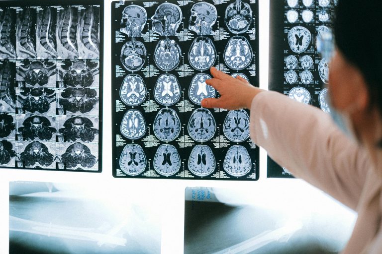 Understanding Age-Related Memory Changes vs. Concerning Signs